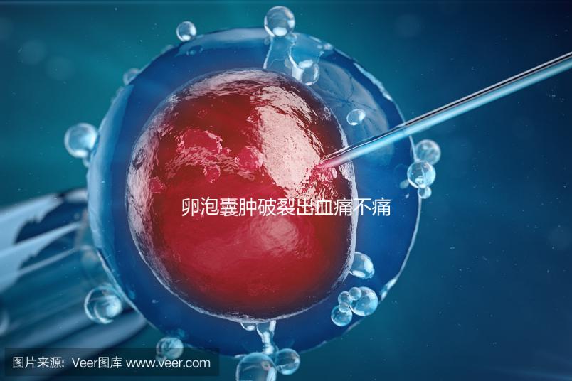 卵泡囊腫破裂出血痛不痛？經歷過的姐妹們給出回應