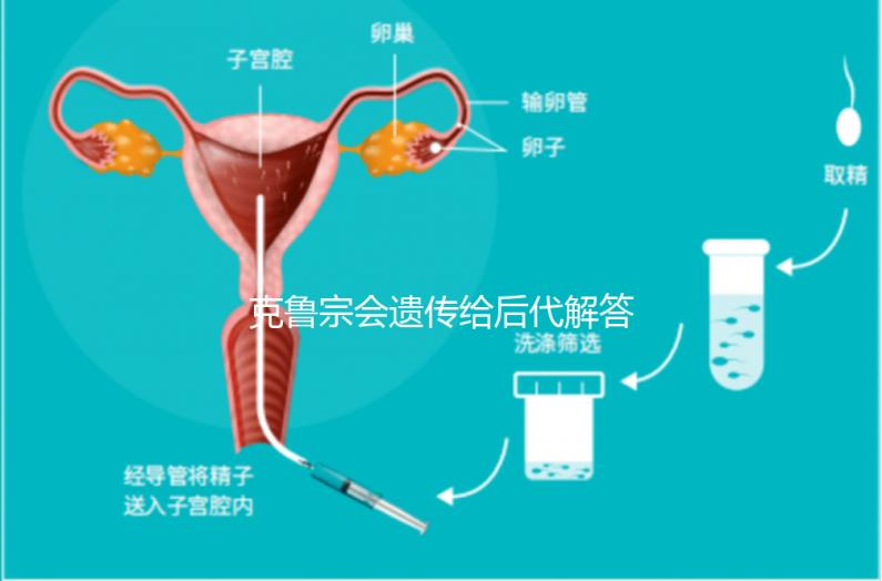 克魯宗會遺傳給后代解答嗎？他生來就有一篇清晰的文章嗎？