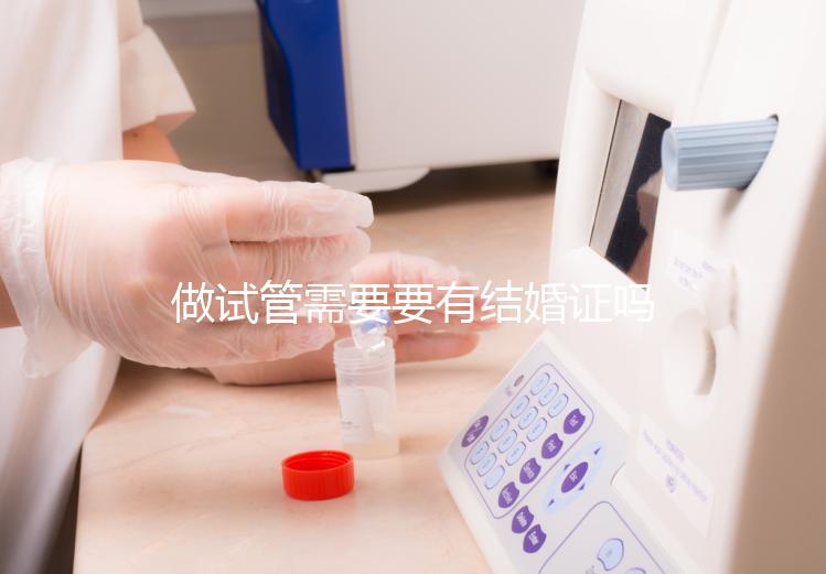 做試管需要要有結(jié)婚證嗎?做試管需要結(jié)婚證