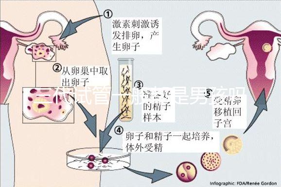 三代試管一般都是男孩嗎(三代試管一般都是男孩嗎還是女孩)