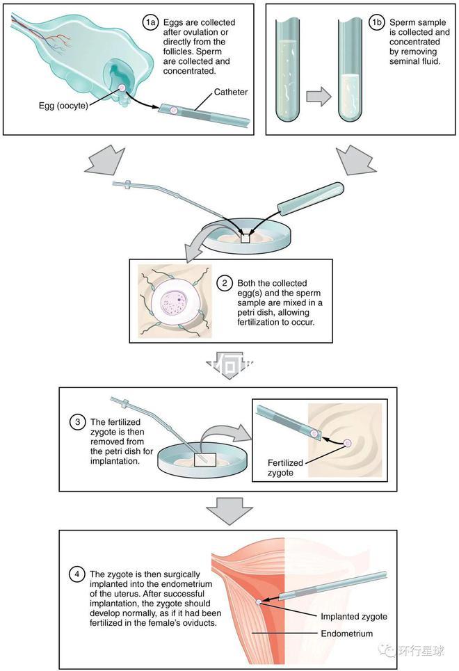 懷孕期間如何降血糖效果更好？