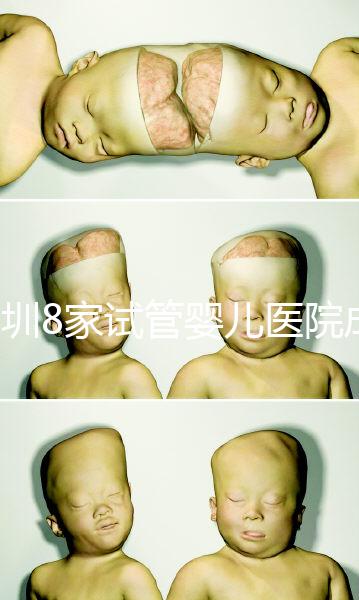 深圳8家試管嬰兒醫(yī)院成功率排名，供卵、供精首選各不同