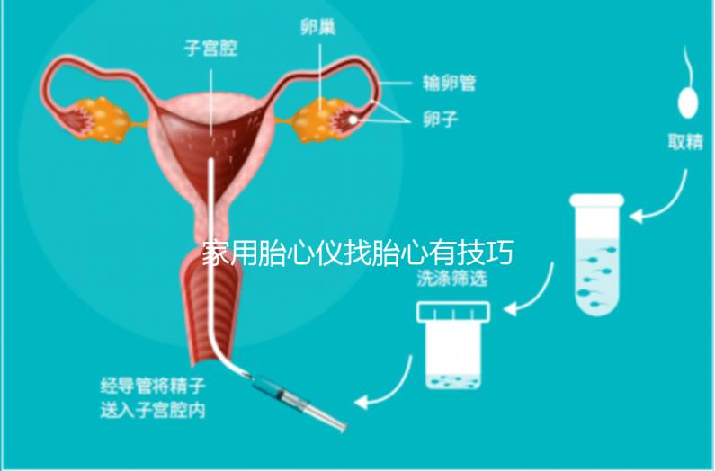 家用胎心儀找胎心有技巧,飯后半個(gè)小時(shí)測(cè)準(zhǔn)確率稍高