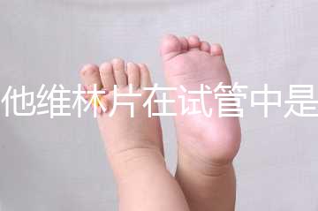 屈他維林片在試管中是否有副作用，導(dǎo)致胎停不是空穴來風(fēng)