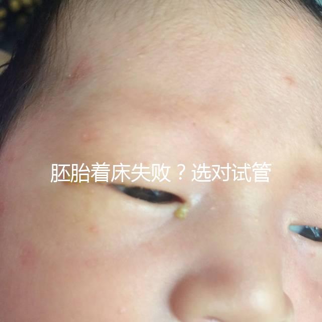 胚胎著床失敗？選對試管嬰兒醫(yī)生很重要