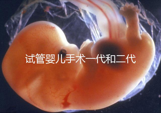 試管嬰兒手術一代和二代有哪些區別?