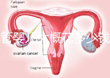 試管嬰兒大概花多少錢(試管嬰兒大概花多少錢費(fèi)用)