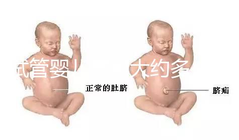 試管嬰兒費用大約多少2021年：一二三代試管分別指的是什么？