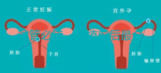 試管必讀，移植前后最全注意事項(xiàng)？