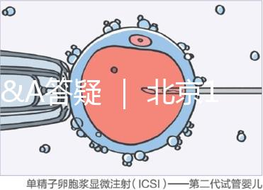 Q&A答疑 ｜ 北京16項輔助生殖技術進醫(yī)保，試管可以報銷嗎？