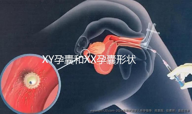 XY孕囊和XX孕囊形狀各有差異，橢圓形可能是懷女哦！